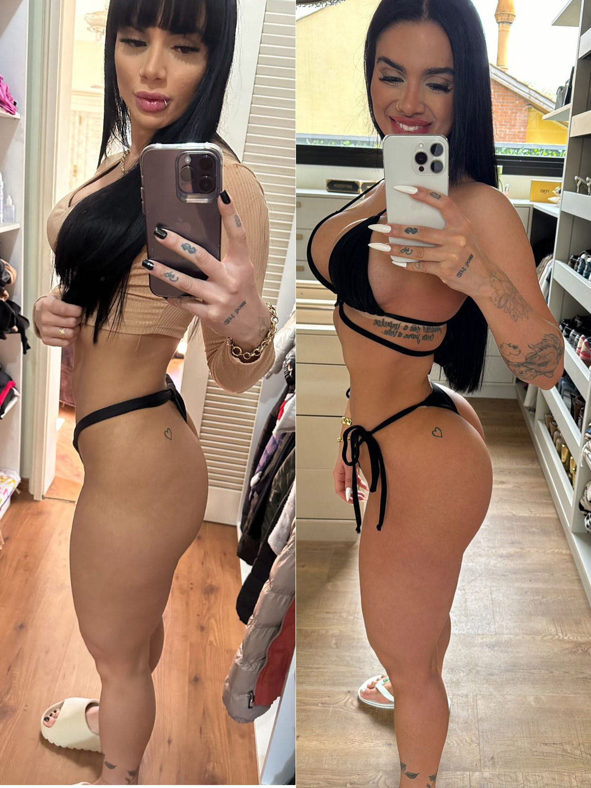 Raíssa Souza mostrou antes e depois do bumbum após procedimento - Foto: Arquivo pessoal