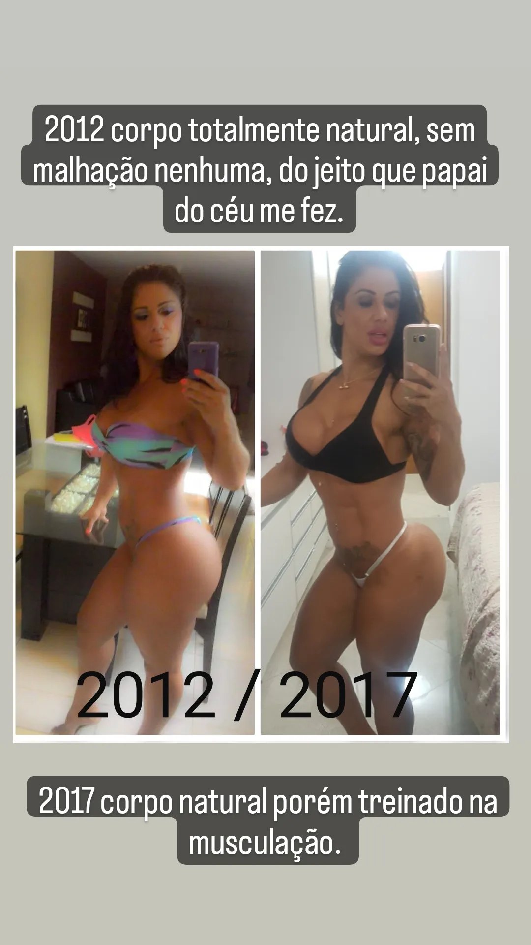 Vanessa Ataídes mostrou antes e depois e falou sobre plásticas - Foto: Reprodução/ Instagram@vanessa.ataidess