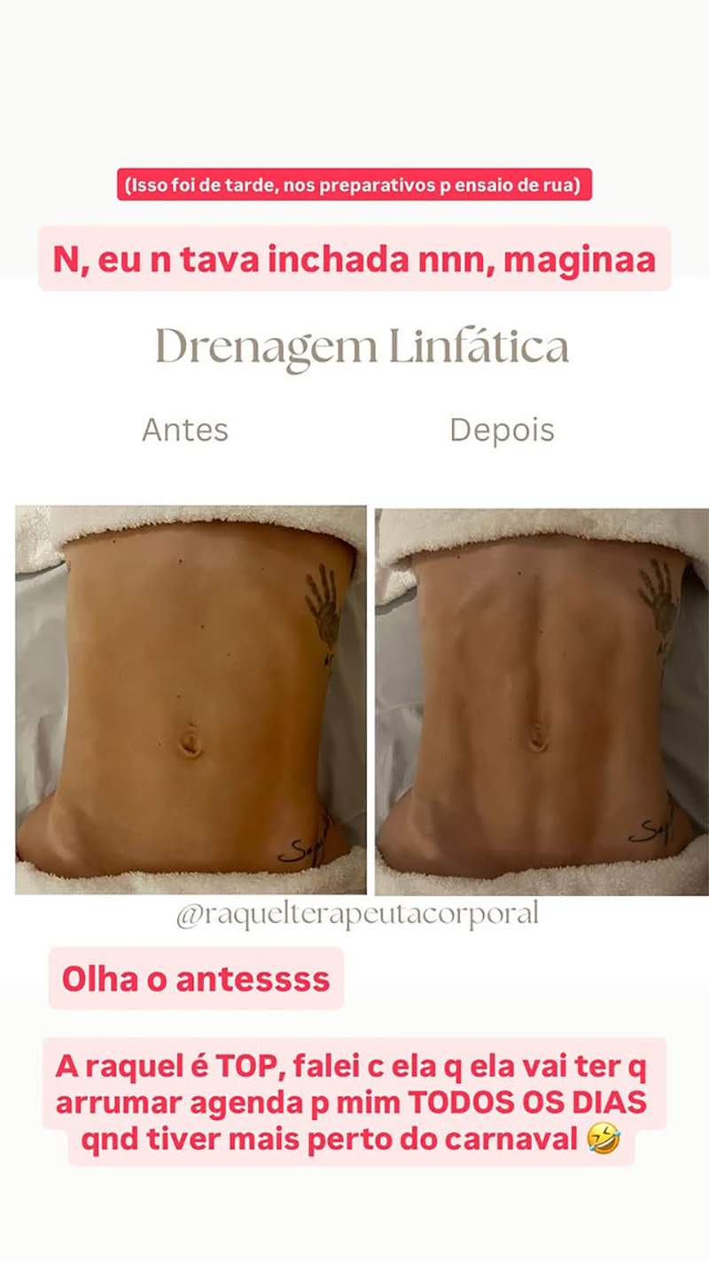 Virginia Fonseca mostrou antes e depois de drenagem linfática - Foto: Reprodução/ Instagram@virginia